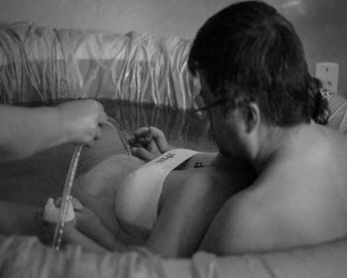 巧囊试管代生🧪#取卵三天后复诊#,代孕中心电话